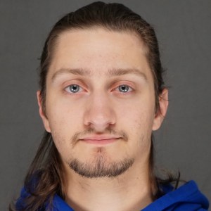 Молодой мужчина, ринопластика, удаление костного горба, вид спереди до операции